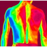 Termoterapia